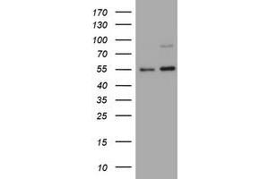 Image no. 6 for anti-Tumor Necrosis Factor Receptor Superfamily, Member 8 (TNFRSF8) (AA 19-379) antibody (ABIN1491084)