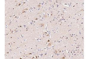 Image no. 1 for anti-Fanconi Anemia, Complementation Group C (FANCC) (N-Term) antibody (ABIN6924697)