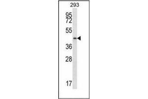 Image no. 2 for anti-Prostaglandin Reductase 2 (PTGR2) (AA 72-102), (N-Term) antibody (ABIN955621)