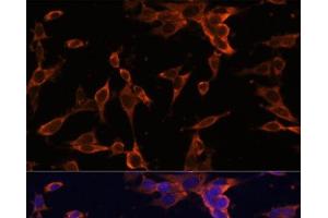 Immunofluorescence analysis of NIH-3T3 cells using USP36 Polyclonal Antibody at dilution of 1:100 (40x lens).