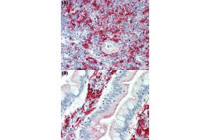 Image no. 2 for anti-Major Histocompatibility Complex, Class II, DR beta 1 (HLA-DRB1) antibody (ABIN5579968)