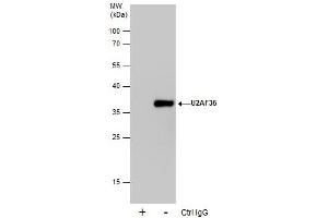 Image no. 1 for anti-U2 Small Nuclear RNA Auxiliary Factor 1 (U2AF1) (Center) antibody (ABIN2856447)