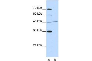 Image no. 1 for anti-Forkhead Box Q1 (FOXQ1) (N-Term) antibody (ABIN2778429)