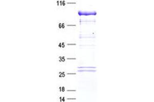Image no. 1 for B-Raf proto-oncogene, serine/threonine kinase (BRAF) protein (Myc-DYKDDDDK Tag) (ABIN2715107)