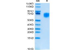 SIRPA Protein (His tag)