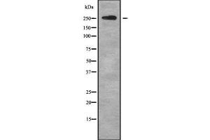 Image no. 1 for anti-ATP-Binding Cassette, Sub-Family A (ABC1), Member 4 (ABCA4) (C-Term) antibody (ABIN6259677)