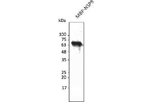 SARS-CoV-2 NSP8 antibody