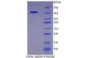 Image no. 1 for Chromogranin B (Secretogranin 1) (CHGB) (AA 315-482) protein (His tag,GST tag) (ABIN1879887)
