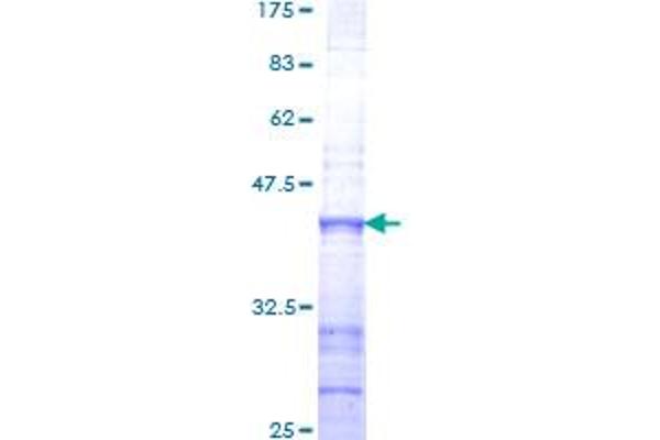 GRF2 Protein (AA 1-110) (GST tag)