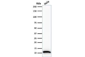 Image no. 8 for anti-S100 Calcium Binding Protein A4 (S100A4) (AA 1-200) antibody (ABIN6940541)