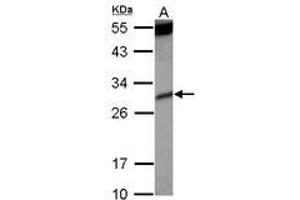Image no. 2 for anti-Killer Cell Immunoglobulin-Like Receptor, Two Domains, Short Cytoplasmic Tail, 4 (KIR2DS4) (AA 1-294) antibody (ABIN1499052)