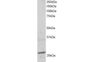 Image no. 2 for anti-RAB11A, Member RAS Oncogene Family (RAB11A) (C-Term) antibody (ABIN184807)