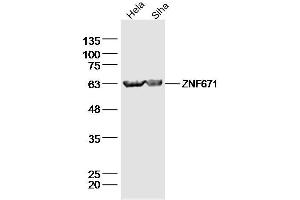 Image no. 1 for anti-Zinc Finger Protein 671 (ZNF671) (AA 101-200) antibody (ABIN5675145)