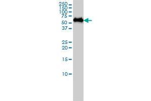 SF3A3 monoclonal antibody (M01A), clone 2E9-2B7 Western Blot analysis of SF3A3 expression in A-431 .