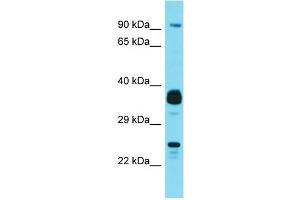 Image no. 1 for anti-Josephin Domain Containing 1 (JOSD1) (N-Term) antibody (ABIN2791598)