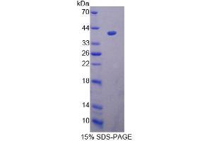 Image no. 1 for Uridine Phosphorylase 2 (UPP2) (AA 1-320) protein (His tag) (ABIN6239566)