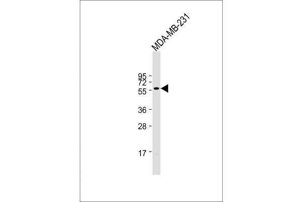 ONECUT3 antibody  (C-Term)