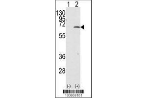 Image no. 1 for anti-Protein Inhibitor of Activated STAT, 1 (PIAS1) (AA 607-637), (C-Term) antibody (ABIN388055)