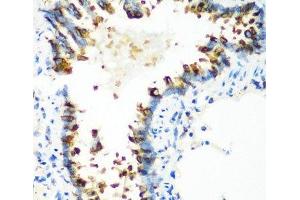 Immunohistochemistry of paraffin-embedded Rat lung using MTCO2 Polyclonal Antibody at dilution of 1:100 (40x lens).