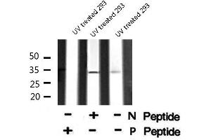 Image no. 4 for anti-Cyclin D1 (CCND1) (pSer90) antibody (ABIN6271254)