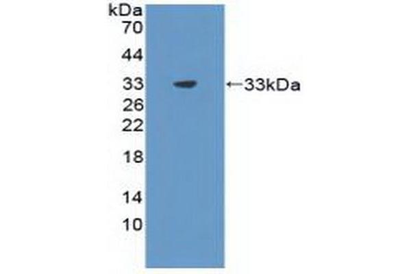 CIDEC Antikörper  (AA 1-221)