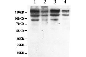 Image no. 2 for anti-Adenosine Deaminase, RNA-Specific (ADAR) (AA 128-346) antibody (ABIN4886426)