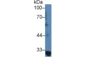 Image no. 2 for anti-TNF Receptor-Associated Factor 1 (TRAF1) (AA 169-392) antibody (ABIN1860858)