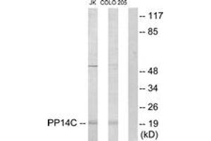 Western blot analysis of extracts from Jurkat/COLO205 cells, using PPP1R14C Antibody.