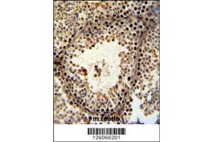 Image no. 1 for anti-PHD Finger Protein 13 (PHF13) (AA 263-291), (C-Term) antibody (ABIN651255)