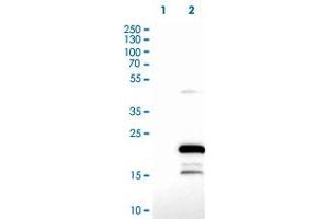 Image no. 1 for anti-Zinc Finger, C3HC-Type Containing 13 (ZCCHC13) antibody (ABIN5650322)