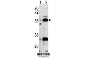Image no. 2 for anti-Pancreatic and Duodenal Homeobox 1 (PDX1) (AA 429-459), (C-Term) antibody (ABIN388773)