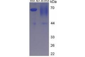 Image no. 1 for Amyloid beta 40 (Abeta 40) peptide (BSA) (ABIN5665937)