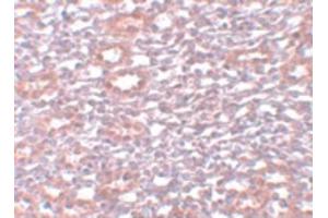 Image no. 2 for anti-Protein Inhibitor of Activated STAT, 1 (PIAS1) (C-Term) antibody (ABIN6656300)