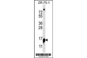 Image no. 1 for anti-Ribonuclease P/MRP 25kDa Subunit (RPP25) (AA 169-197), (C-Term) antibody (ABIN657030)