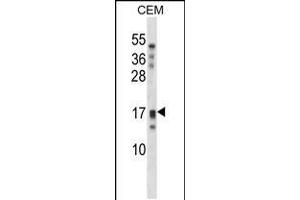 Image no. 2 for anti-Kallikrein-Related Peptidase 15 (KLK15) (AA 78-106) antibody (ABIN5536342)