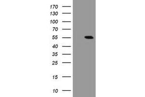 Image no. 1 for anti-rho GTPase Activating Protein 2 (ARHGAP2) antibody (ABIN2716337)