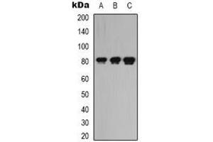Image no. 2 for anti-Leucine Rich Repeat Containing 41 (LRRC41) antibody (ABIN2957658)