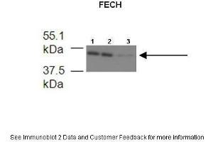Image no. 2 for anti-Ferrochelatase (FECH) (Middle Region) antibody (ABIN2773789)