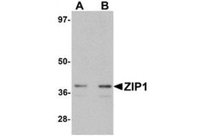 Image no. 1 for anti-Solute Carrier Family 39 (Zinc Transporter), Member 1 (SLC39A1) (N-Term) antibody (ABIN783795)