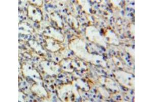 Image no. 3 for anti-Linker For Activation of T Cells (LAT) (AA 33-227) antibody (ABIN1868913)