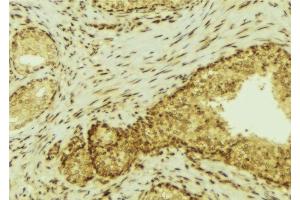 Image no. 2 for anti-Feline Sarcoma Oncogene (FES) antibody (ABIN6261715)
