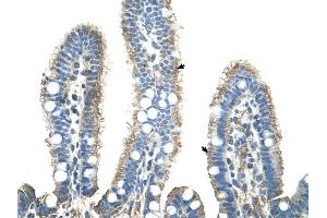Image no. 1 for anti-Amyloid P Component, Serum (APCS) (N-Term) antibody (ABIN630228)