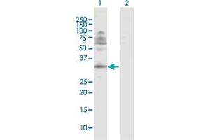 Image no. 4 for anti-Inhibitor of Growth Family, Member 4 (ING4) (AA 1-249) antibody (ABIN526498)