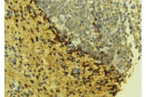 Image no. 1 for anti-Carboxylesterase 2 (CES2) (N-Term) antibody (ABIN6266331)