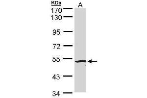 Image no. 2 for anti-Activin A Receptor Type II-Like 1 (ACVRL1) (C-Term) antibody (ABIN2857028)
