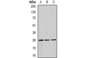 Image no. 1 for anti-Complement Component 4 Binding Protein, beta (C4BPB) (full length) antibody (ABIN6004302)