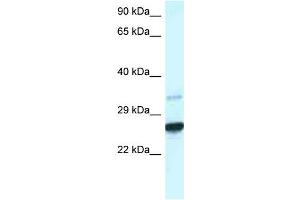 Image no. 1 for anti-Caudal Type Homeobox 1 (CDX1) (C-Term) antibody (ABIN2780383)