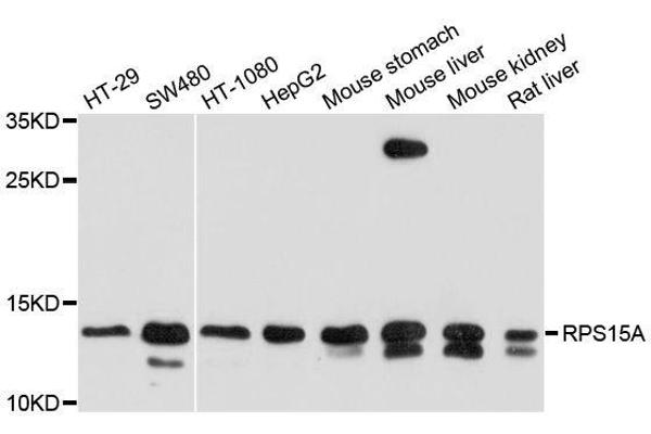 anti-Ribosomal Protein S15a (RA) antibody