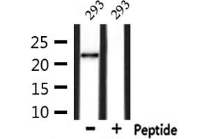anti-Glutathione Peroxidase 4 (GPX4) (C-Term) antibody
