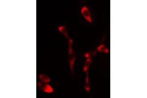 Image no. 1 for anti-SHC (Src Homology 2 Domain Containing) Transforming Protein 1 (SHC1) (pTyr349) antibody (ABIN6255897)